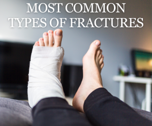 Most Common Types of Fractures